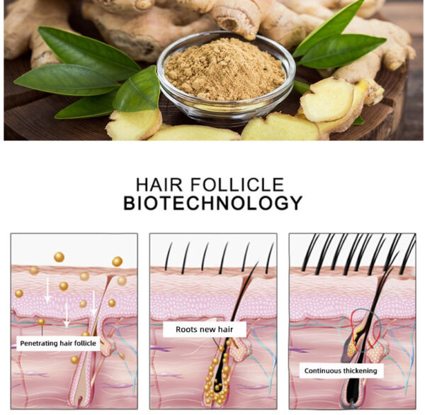 Hair Growth Oil Hair Growth Oil Oem Hair Care Essential Oil - Image 4