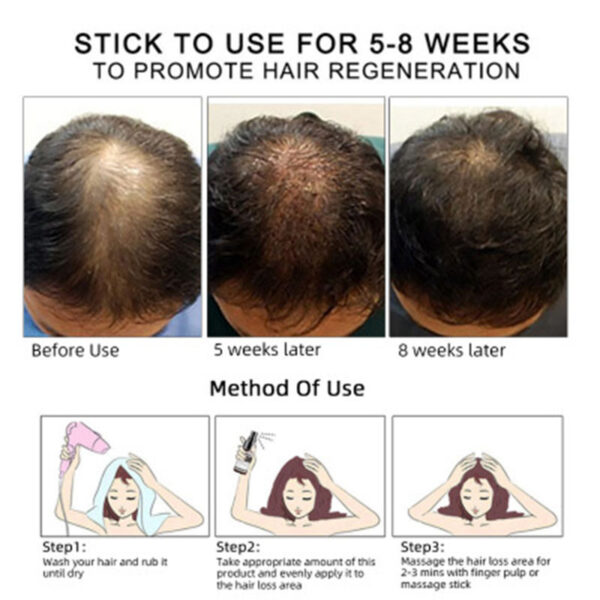 Hair Growth Oil Hair Growth Oil Oem Hair Care Essential Oil - Image 3